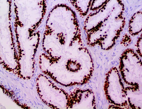 IHC of FOXA1 / HNF-3A on an FFPE Colon Tissue